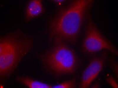 Immunocytochemistry/Immunofluorescence: MARCKS [p Ser158] Antibody [NBP3-05422] - Immunofluorescence analysis of methanol-fixed HeLa cells using MARCKS antibody (NBP3-05422).